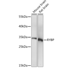 Western Blot - Anti-RYBP Antibody (A91523) - Antibodies.com