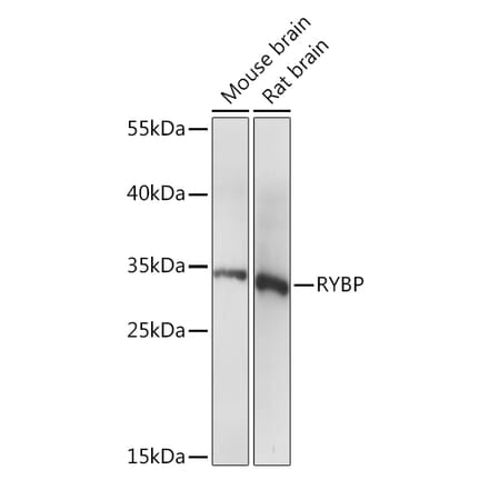 Western Blot - Anti-RYBP Antibody (A91523) - Antibodies.com