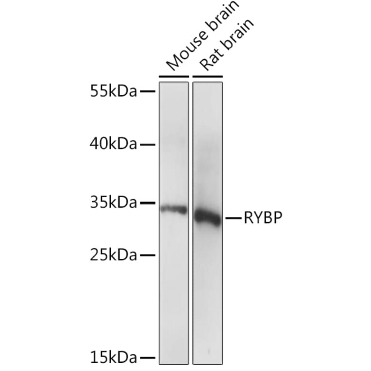 Western Blot - Anti-RYBP Antibody (A91523) - Antibodies.com