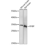 Western Blot - Anti-RYBP Antibody (A91523) - Antibodies.com