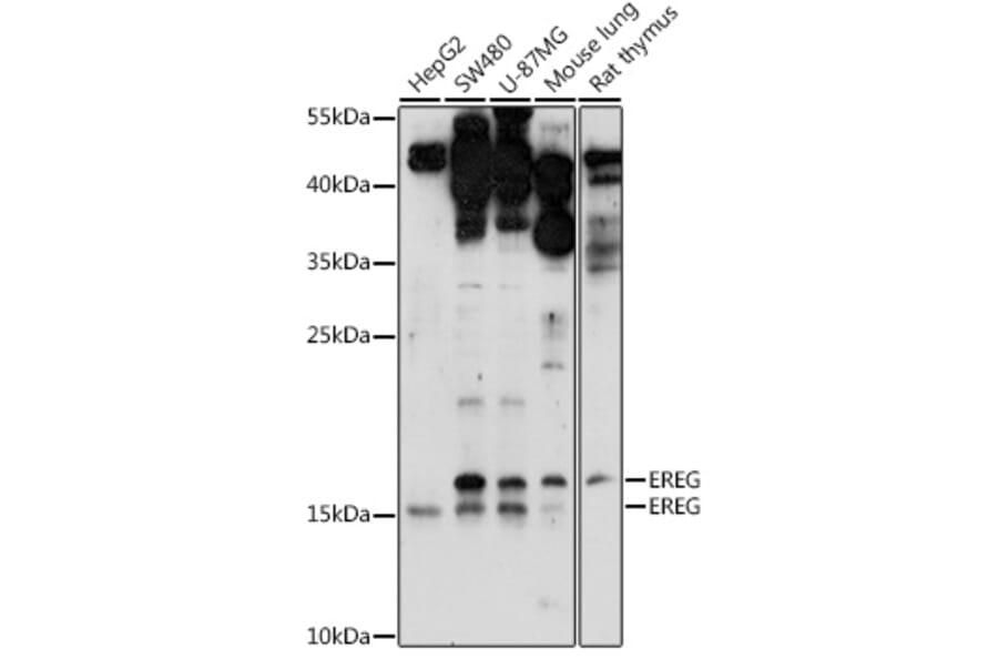 Western Blot - Anti-Epiregulin Antibody (A91524) - Antibodies.com