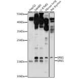 Western Blot - Anti-Epiregulin Antibody (A91524) - Antibodies.com