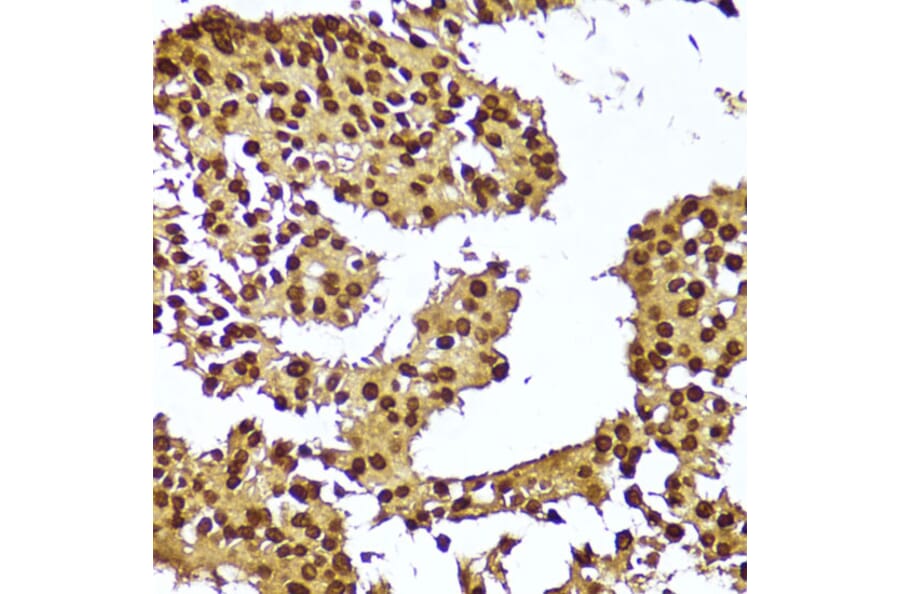 Immunohistochemistry - Anti-Telomerase reverse transcriptase Antibody (A91526) - Antibodies.com