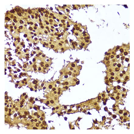 Immunohistochemistry - Anti-Telomerase reverse transcriptase Antibody (A91526) - Antibodies.com