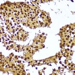 Immunohistochemistry - Anti-Telomerase reverse transcriptase Antibody (A91526) - Antibodies.com