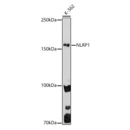 Western Blot - Anti-NLRP1 Antibody (A91527) - Antibodies.com