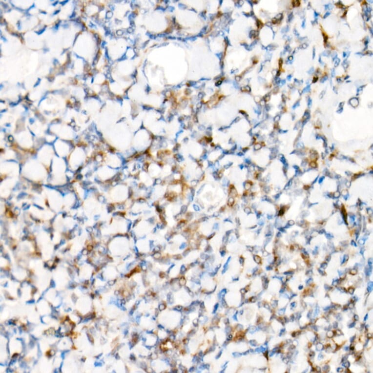 Immunohistochemistry - Anti-NLRP1 Antibody (A91527) - Antibodies.com