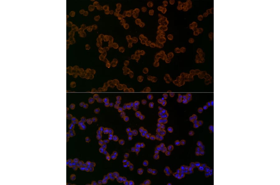 Immunofluorescence - Anti-NLRP1 Antibody (A91527) - Antibodies.com