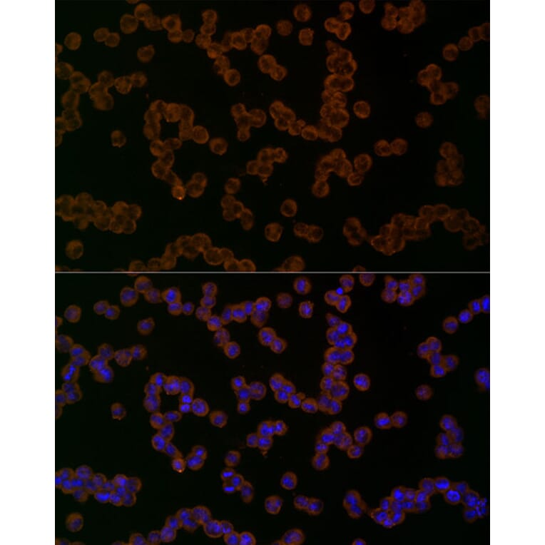 Immunofluorescence - Anti-NLRP1 Antibody (A91527) - Antibodies.com