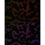 Immunofluorescence - Anti-NLRP1 Antibody (A91527) - Antibodies.com