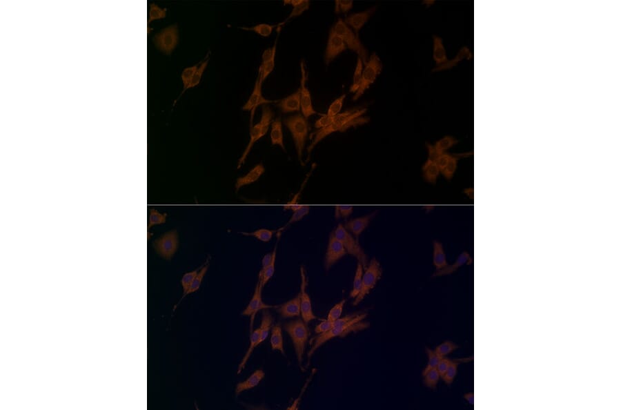 Immunofluorescence - Anti-NLRP1 Antibody (A91527) - Antibodies.com