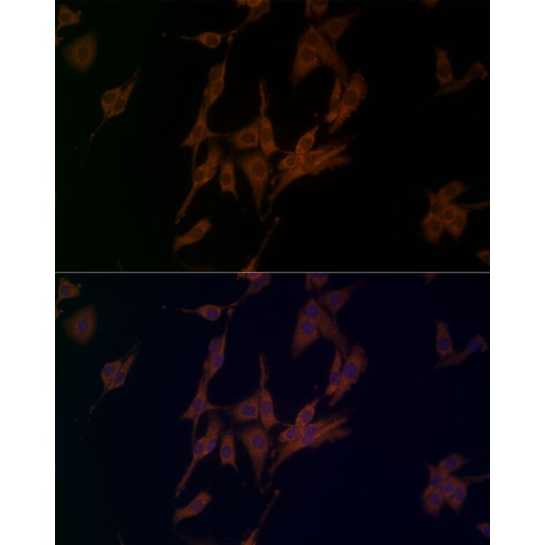 Immunofluorescence - Anti-NLRP1 Antibody (A91527) - Antibodies.com