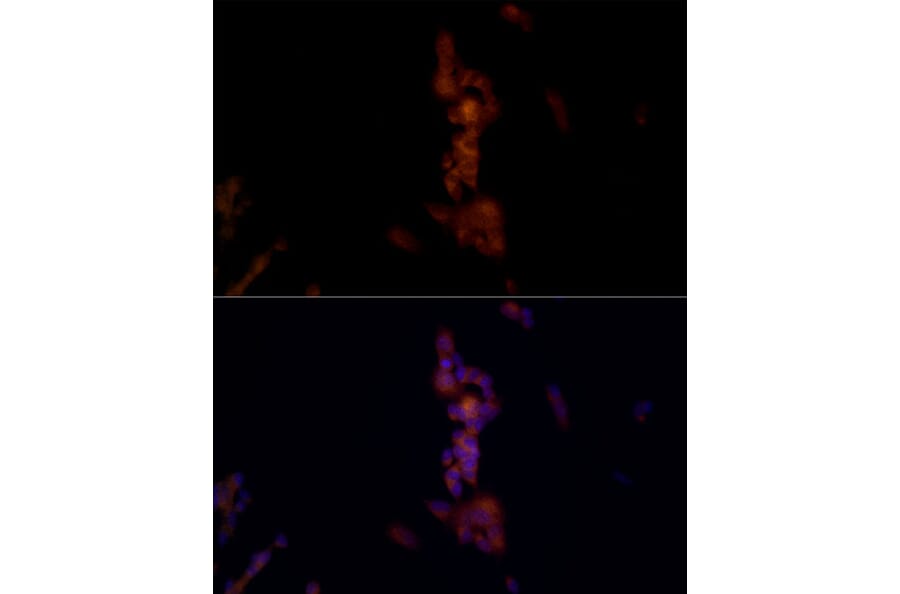 Immunofluorescence - Anti-NLRP1 Antibody (A91527) - Antibodies.com