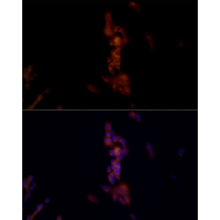 Immunofluorescence - Anti-NLRP1 Antibody (A91527) - Antibodies.com