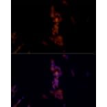 Immunofluorescence - Anti-NLRP1 Antibody (A91527) - Antibodies.com