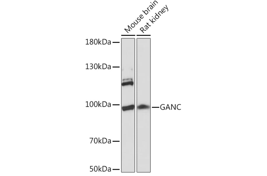 Western Blot - Anti-GANC Antibody (A91530) - Antibodies.com