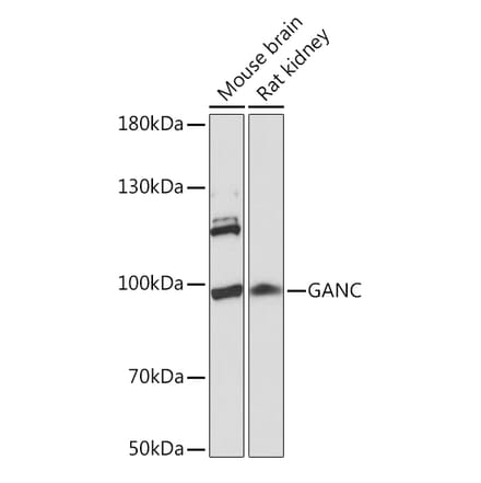 Western Blot - Anti-GANC Antibody (A91530) - Antibodies.com
