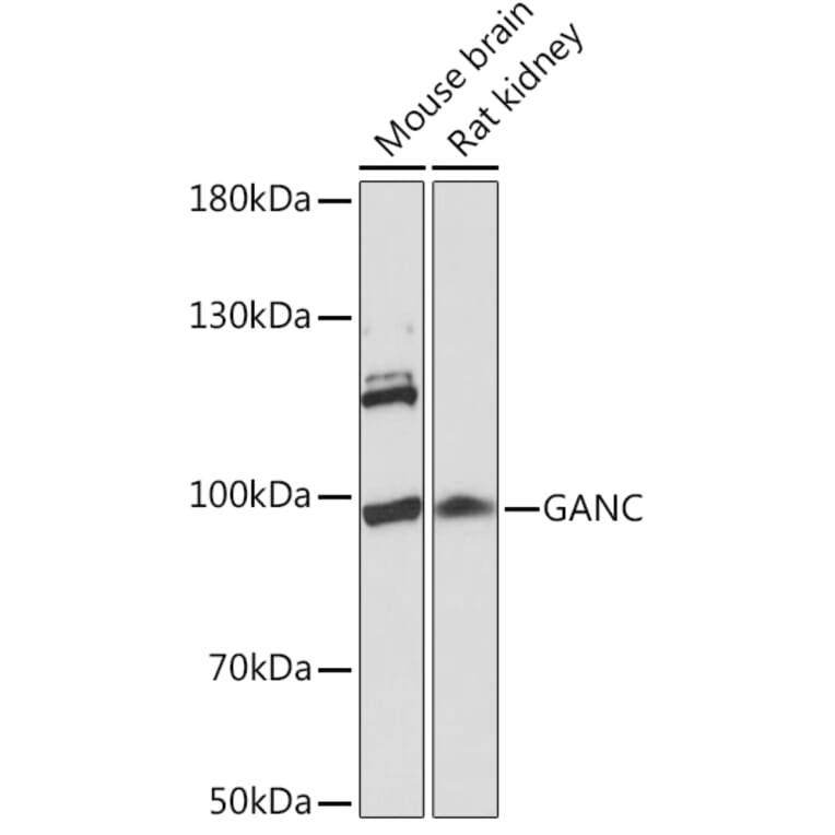 Western Blot - Anti-GANC Antibody (A91530) - Antibodies.com