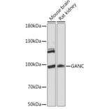 Western Blot - Anti-GANC Antibody (A91530) - Antibodies.com