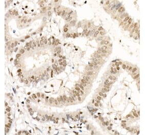 Immunohistochemistry - Anti-NR2F1 Antibody (A91531) - Antibodies.com