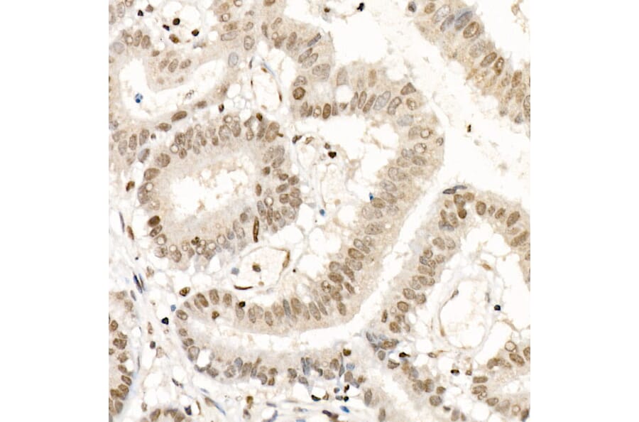 Immunohistochemistry - Anti-NR2F1 Antibody (A91531) - Antibodies.com