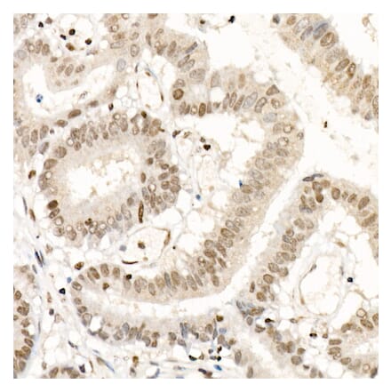 Immunohistochemistry - Anti-NR2F1 Antibody (A91531) - Antibodies.com