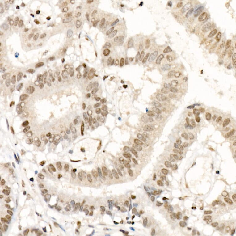Immunohistochemistry - Anti-NR2F1 Antibody (A91531) - Antibodies.com