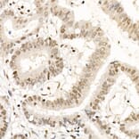 Immunohistochemistry - Anti-NR2F1 Antibody (A91531) - Antibodies.com