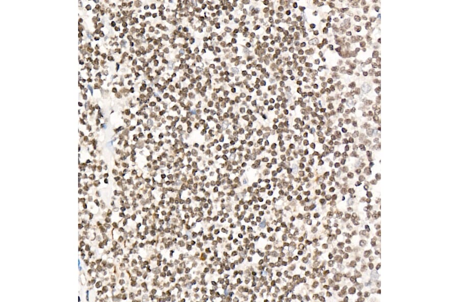 Immunohistochemistry - Anti-NR2F1 Antibody (A91531) - Antibodies.com