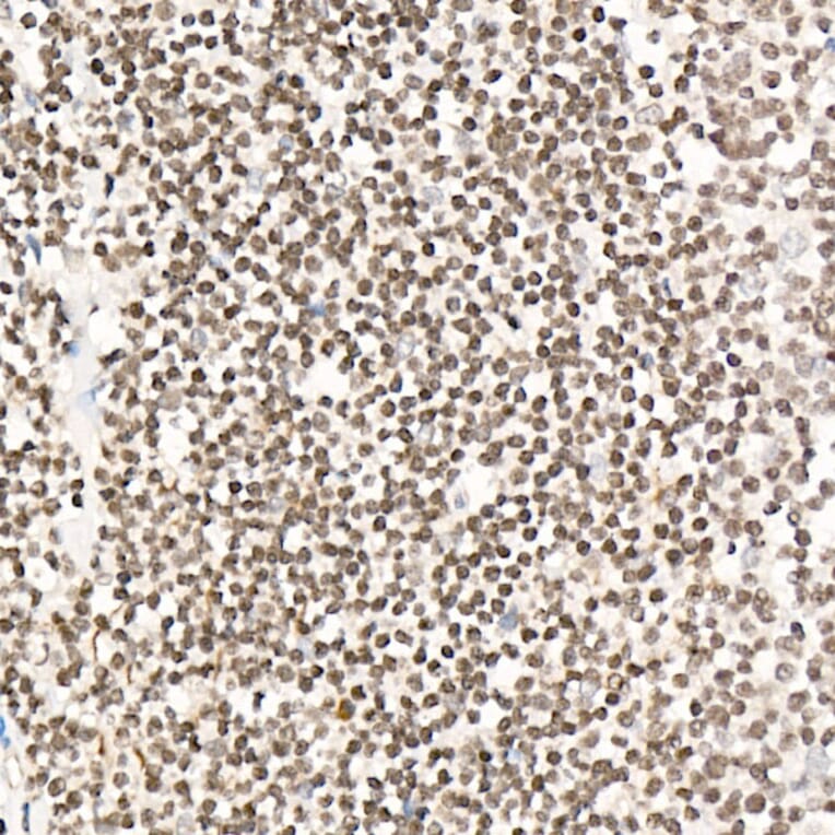 Immunohistochemistry - Anti-NR2F1 Antibody (A91531) - Antibodies.com