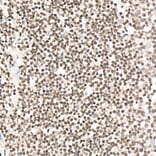 Immunohistochemistry - Anti-NR2F1 Antibody (A91531) - Antibodies.com