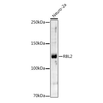 Western Blot - Anti-Rb2 p130 Antibody (A91532) - Antibodies.com