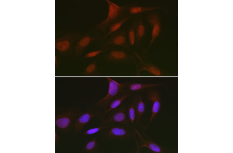 Immunofluorescence - Anti-Rb2 p130 Antibody (A91532) - Antibodies.com