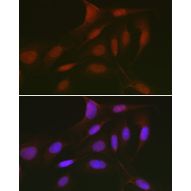 Immunofluorescence - Anti-Rb2 p130 Antibody (A91532) - Antibodies.com