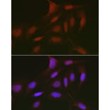 Immunofluorescence - Anti-Rb2 p130 Antibody (A91532) - Antibodies.com