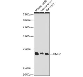 Western Blot - Anti-TIMP2 Antibody (A91534) - Antibodies.com