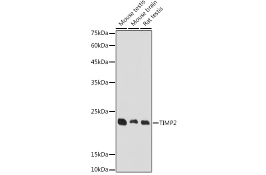 Western Blot - Anti-TIMP2 Antibody (A91534) - Antibodies.com