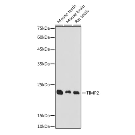 Western Blot - Anti-TIMP2 Antibody (A91534) - Antibodies.com
