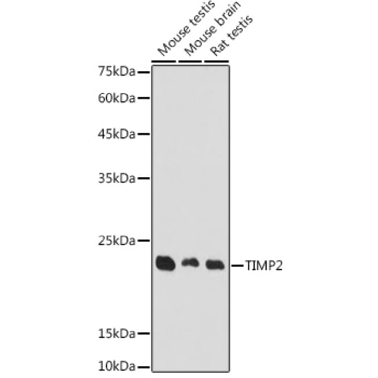 Western Blot - Anti-TIMP2 Antibody (A91534) - Antibodies.com