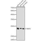 Western Blot - Anti-TIMP2 Antibody (A91534) - Antibodies.com