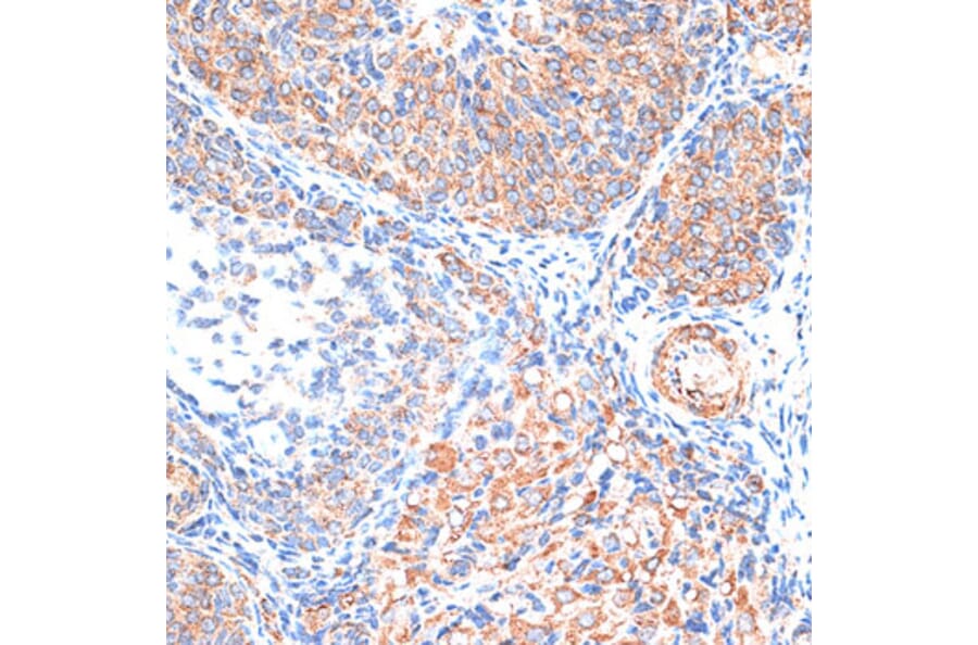 Immunohistochemistry - Anti-TIMP2 Antibody (A91534) - Antibodies.com
