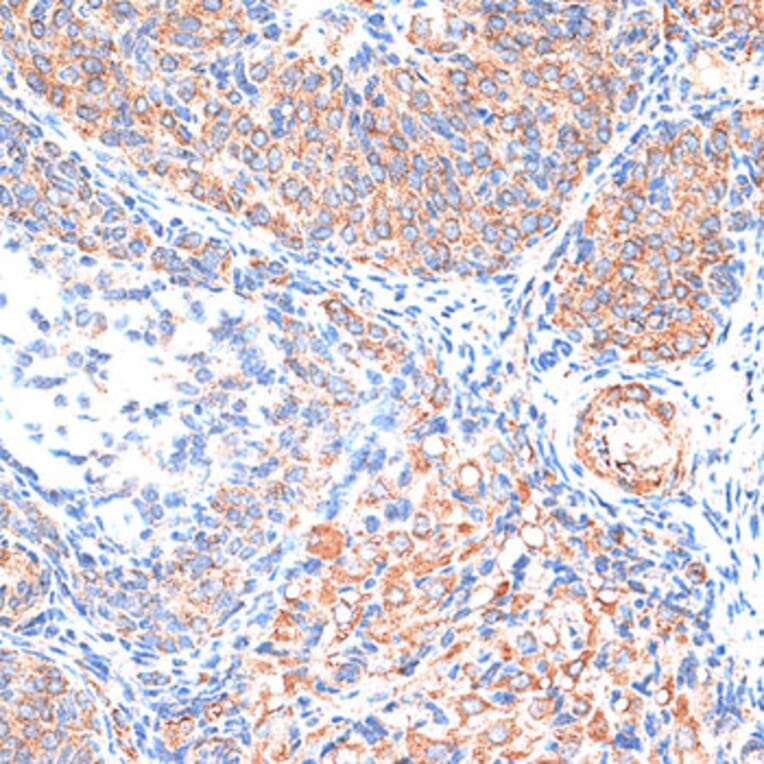 Immunohistochemistry - Anti-TIMP2 Antibody (A91534) - Antibodies.com