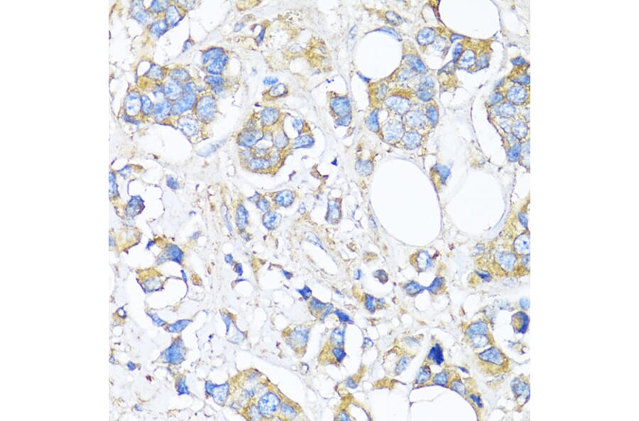 Immunohistochemistry - Anti-TIMP2 Antibody (A91534) - Antibodies.com
