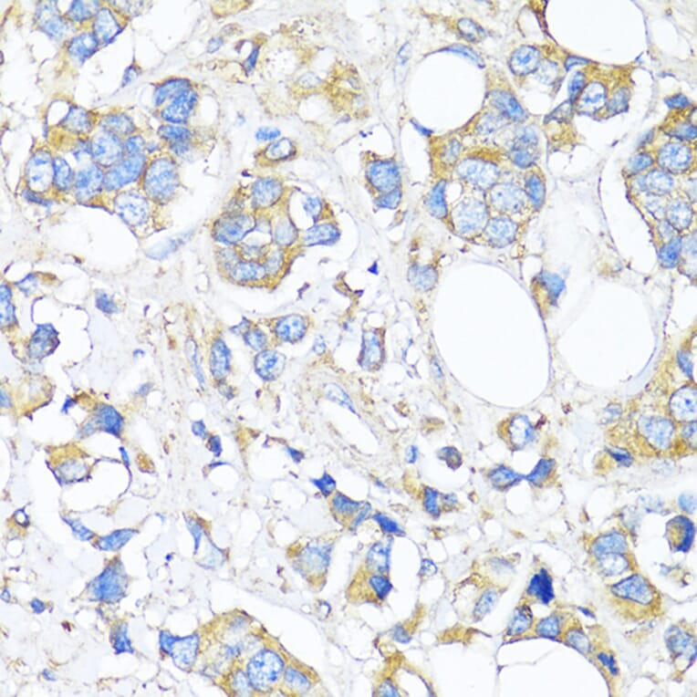 Immunohistochemistry - Anti-TIMP2 Antibody (A91534) - Antibodies.com