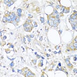 Immunohistochemistry - Anti-TIMP2 Antibody (A91534) - Antibodies.com