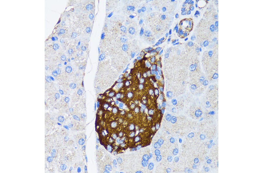 Immunohistochemistry - Anti-TIMP2 Antibody (A91534) - Antibodies.com