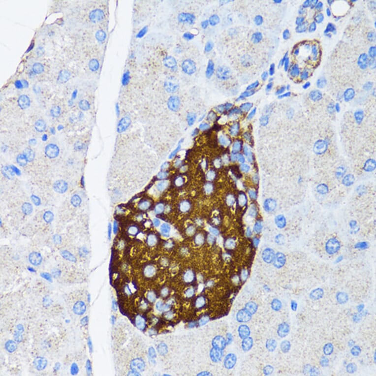 Immunohistochemistry - Anti-TIMP2 Antibody (A91534) - Antibodies.com