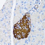 Immunohistochemistry - Anti-TIMP2 Antibody (A91534) - Antibodies.com