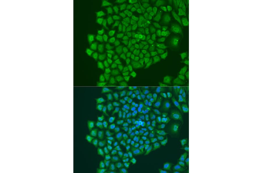 Immunofluorescence - Anti-YB1 Antibody (A91535) - Antibodies.com