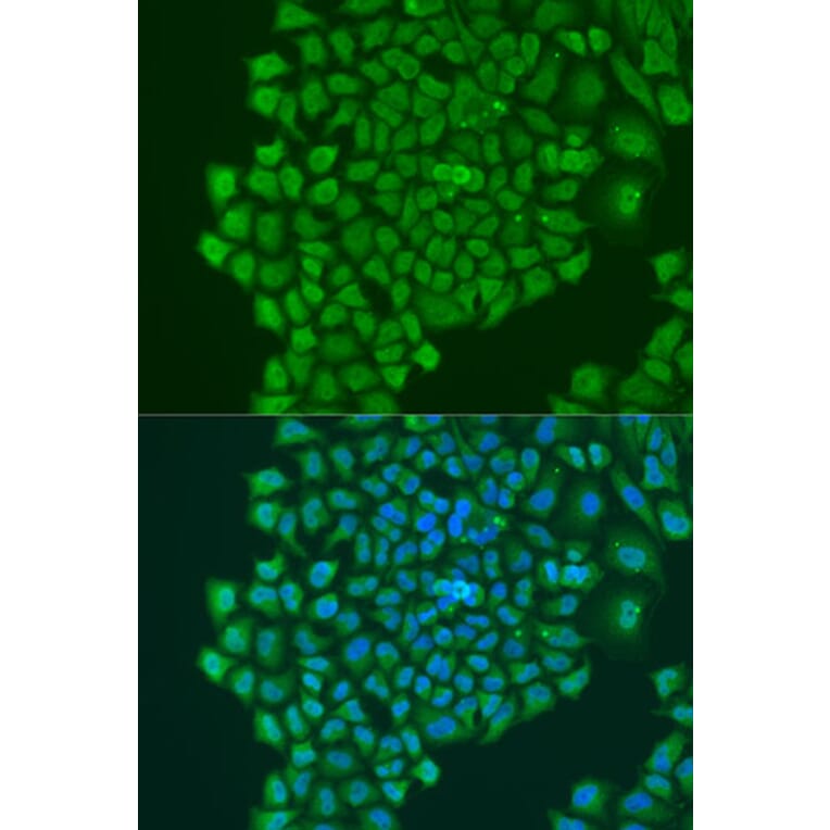 Immunofluorescence - Anti-YB1 Antibody (A91535) - Antibodies.com